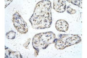 Immunohistochemistry (IHC) image for anti-Peroxisome Proliferator-Activated Receptor delta (PPARD) (N-Term) antibody (ABIN2780757)