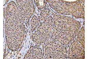 IHC analysis of HOXC4 using anti-HOXC4 antibody (ABIN7603059). (HOXC4 抗体  (Middle Region))
