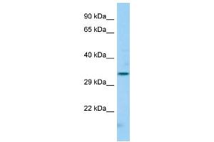 Host: Rabbit Target Name: FCGR2C Sample Type: Hela Whole cell lysates Antibody Dilution: 1. (FCGR2C 抗体  (N-Term))