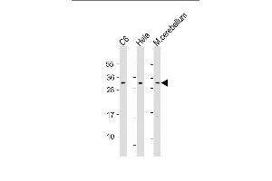 All lanes : Anti- at 1:1000 dilution Lane 1: C6 whole cell lysate Lane 2: Hela whole cell lysate Lane 3: mouse cerebellum lysate Lysates/proteins at 20 μg per lane. (PAK1IP1 抗体  (AA 248-277))