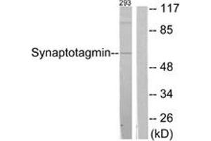 Western blot analysis of extracts from 293 cells, treated with Forskolin 40nM 30', using Synaptotagmin (Ab-309) Antibody. (Synaptotagmin 抗体  (AA 276-325))