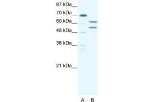 Western Blotting (WB) image for anti-Zinc Finger and BTB Domain Containing 43 (ZBTB43) antibody (ABIN2460282) (ZBTB43 抗体)