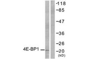 Western blot analysis of extracts from MDA-MB-435 cells, treated with EGF 200ng/ml 30', using 4E-BP1 (Ab-36) Antibody. (eIF4EBP1 抗体  (AA 4-53))