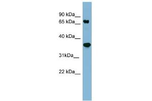 WB Suggested Anti-PPP2R1B Antibody Titration: 0. (PPP2R1B 抗体  (N-Term))