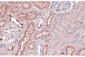 Immunohistochemistry of paraffin-embedded Mouse kidney using LYZ Polyclonal Antibody at dilution of 1:100 (40x lens). (LYZ 抗体)