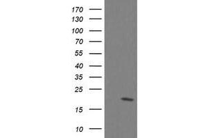 Image no. 8 for anti-Ubiquitin-Conjugating Enzyme E2G 2 (UBE2G2) antibody (ABIN1501631)