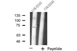 Western Blotting (WB) image for anti-RAP1 GTPase Activating Protein (RAP1GAP) (Internal Region) antibody (ABIN6257821)