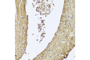 Immunohistochemistry of paraffin-embedded mouse heart using PIK3C2A antibody (ABIN5995585) at dilution of 1/100 (40x lens). (PIK3C2A 抗体)