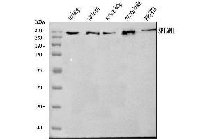 Western blot analysis of NEAS/SPTAN1 using anti-NEAS/SPTAN1 antibody (ABIN7600436).