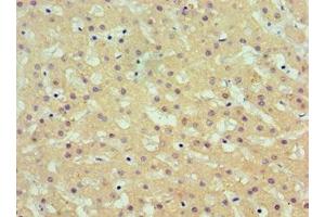 Immunohistochemistry of paraffin-embedded human liver tissue using ABIN7143695 at dilution of 1:100 (AKR1C4 抗体  (AA 1-323))