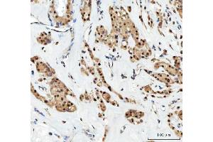 IHC analysis of Aurora A/AURKA using anti-Aurora A/AURKA antibody (ABIN7600751).