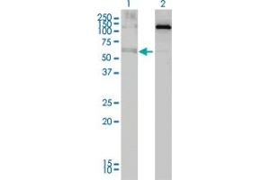 Western Blot analysis of ALAS2 expression in transfected 293T cell line by ALAS2 monoclonal antibody (M01), clone 6C1. (ALAS2 抗体  (AA 1-100))