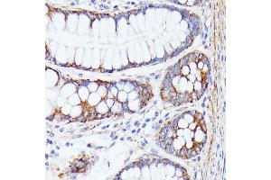 Immunohistochemistry (IHC) image for anti-Protein tyrosine Phosphatase Type IVA, Member 2 (PTP4A2) (AA 30-100) antibody (ABIN7269703)
