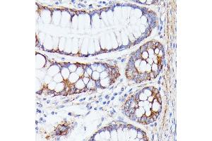 Immunohistochemistry of paraffin-embedded human colon using PTP4 antibody (ABIN7269703) at dilution of 1:100 (40x lens). (PTP4A2 抗体  (AA 30-100))