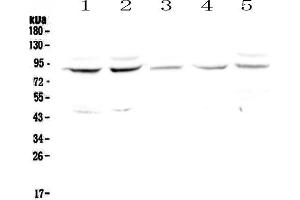 Western blot analysis of Cullin 4a using anti-Cullin 4a antibody . (Cullin 4A 抗体  (AA 494-759))