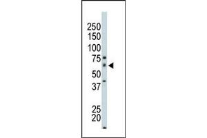 Image no. 1 for anti-P21-Activated Kinase 4 (PAK4) (N-Term) antibody (ABIN360324) (PAK4 抗体  (N-Term))