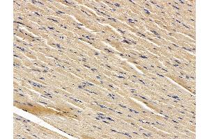 ABIN7096271 and ABIN7100333 at 1/100 staining rat muscle tissue by IHC-P. (RNF145 抗体)