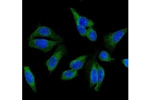 IF analysis of GSTM1 using anti-GSTM1 antibody (ABIN5693234). (GSTM1 抗体)