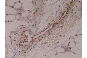 Immunohistochemistry (IHC) image for anti-Proteasome (Prosome, Macropain) 26S Subunit, Non-ATPase, 13 (PSMD13) (AA 1-378) antibody (ABIN7442168)