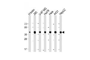 All lanes : Anti-TO Antibody (N-Term) at 1:2000 dilution Lane 1: Human brain lysate Lane 2: 293 whole cell lysate Lane 3: U-87 MG whole cell lysate Lane 4: Hut78 whole cell lysate Lane 5: Hela whole cell lysate Lane 6: A431 whole cell lysate Lane 7: HepG2 whole cell lysate Lysates/proteins at 20 μg per lane. (TOMM40 抗体  (AA 22-56))