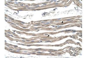 SLC25A22 antibody was used for immunohistochemistry at a concentration of 4-8 ug/ml to stain Skeletal muscle cells (arrows) in Human Muscle. (SLC25A22 抗体)