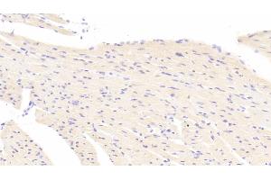 Detection of ATG7 in Mouse Heart Tissue using Polyclonal Antibody to Autophagy Related Protein 7 (ATG7) (ATG7 抗体  (AA 477-698))