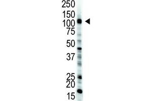 Western Blotting (WB) image for anti-E1 Ubiquitin antibody (ABIN3001449) (E1 Ubiquitin 抗体)