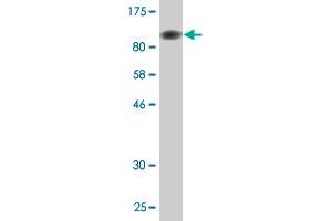 Western Blot detection against Immunogen (95. (SF3B2 抗体  (AA 1-636))