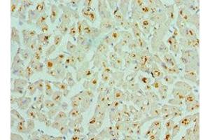 Immunohistochemistry of paraffin-embedded human heart tissue using ABIN7142986 at dilution of 1:100 (ASAH1 抗体  (AA 146-395))