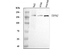 Western blot analysis of TRPM2 using anti-TRPM2 antibody (ABIN7601608).