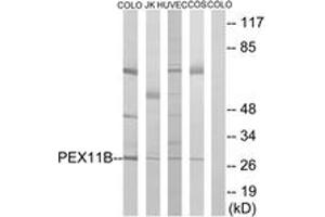 Western Blotting (WB) image for anti-Peroxisomal Biogenesis Factor 11 beta (PEX11B) (AA 91-140) antibody (ABIN2890490) (PEX11B 抗体  (AA 91-140))