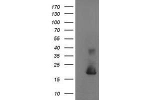 Image no. 1 for anti-Cystatin S (CST4) antibody (ABIN1497667) (CST4 抗体)