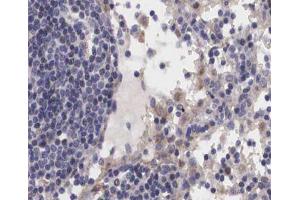 ABIN6267239 at 1/200 staining human Lymph node tissue sections by IHC-P. (JAK2 抗体  (pTyr1007))