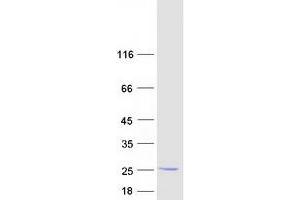 Western Blotting (WB) image for PPPDE Peptidase Domain Containing 2 (PPPDE2) protein (Myc-DYKDDDDK Tag) (ABIN2729519)