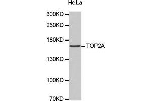 Western Blotting (WB) image for anti-Topoisomerase (DNA) II alpha 170kDa (TOP2A) antibody (ABIN1683096)