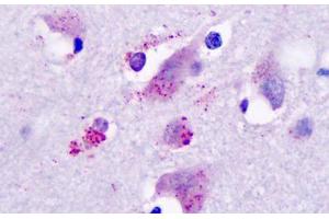 Anti-Histamine 3 Receptor / HRH3 antibody IHC staining of human brain, neurons and glia. (HRH3 抗体  (Cytoplasmic Domain))