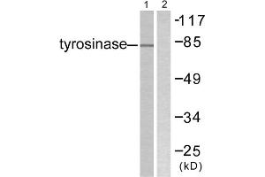 Western blot analysis of extracts from COS7 cells, treated with UV (30mins), using Tyrosinase antibody. (TYR 抗体  (C-Term))