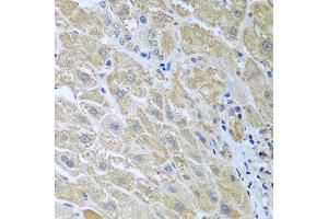 Immunohistochemistry of paraffin-embedded human liver using WDR48 antibody at dilution of 1:100 (40x lens). (WDR48 抗体)