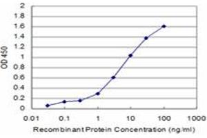Detection limit for recombinant GST tagged BRD3 is approximately 0. (BRD3 抗体  (AA 418-556))