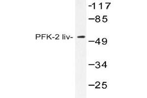 Western blot (WB) analysis of AP20411PU-N PFK-2 liv antibody in extracts from HUVEC cells. (PFKFB1 抗体)