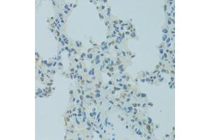 Immunohistochemistry of paraffin-embedded rat lung using MBD2 antibody. (MBD2 抗体)
