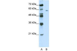 WB Suggested Anti-BTBD14A  Antibody Titration: 0. (BTBD14A 抗体  (C-Term))