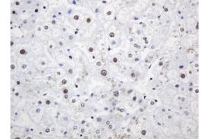 Image no. 5 for anti-Proliferating Cell Nuclear Antigen (PCNA) antibody (ABIN1500061)