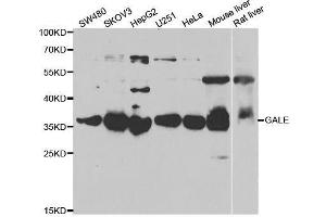 Western blot analysis of extracts of various cell lines, using GALE antibody. (GALE 抗体  (AA 129-348))