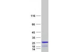Western Blotting (WB) image for Protein Tyrosine Phosphatase Type IVA, Member 1 (PTP4A1) protein (Myc-DYKDDDDK Tag) (ABIN2730094)