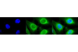 Immunocytochemistry/Immunofluorescence analysis using Rabbit Anti-GRP94 Polyclonal Antibody (ABIN1686652 and ABIN1686653). (GRP94 抗体  (C-Term))