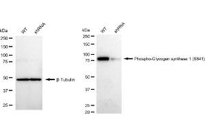Western blotting analysis using Phospho-Glycogen synthase 1 (S641) antibody (ABIN7798774).