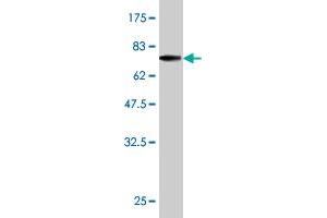 Western Blotting (WB) image for anti-Excision Repair Cross-Complementing Rodent Repair Deficiency, Complementation Group 2 (ERCC2) (AA 1-405) antibody (ABIN515384)