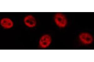 ABIN6277119 staining  HeLa cells by IF/ICC. (p63 抗体)
