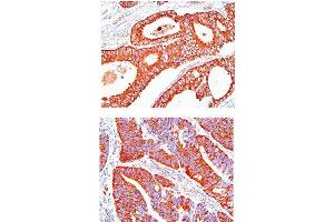 Immunohistochemistry (IHC) image for anti-Heat Shock 60kDa Protein 1 (Chaperonin) (HSPD1) (AA 1-573), (N-Term) antibody (ABIN263917) (HSPD1 抗体  (N-Term))